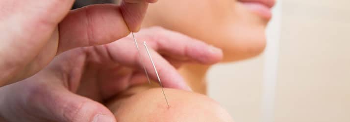Acupuncture Gowrie IA Acupuncture Acupuncture Gowrie IA Acupuncture